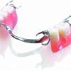 Partial Denture Partial Denture